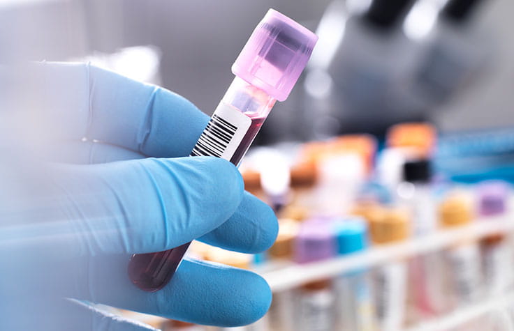 liquid biopsy tube