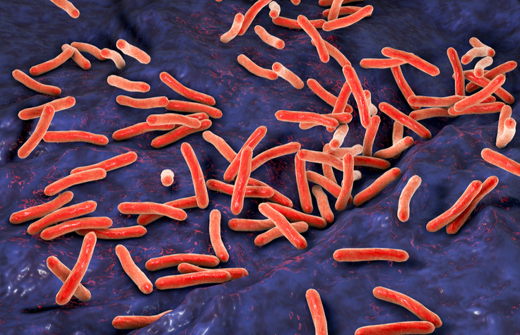 Tuberculosis